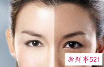 几招教你科学的祛斑含番茄祛斑法