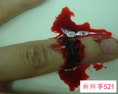 梦见伤口流血不止是什么意思