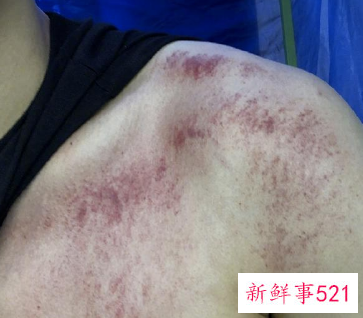 黄景瑜全身多处关节受损，陈学冬道出原因