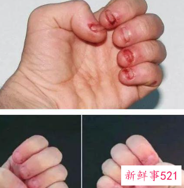 孩子经常咬手指是什么原因