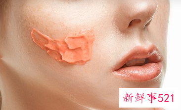 如何让脸上毛孔变细腻