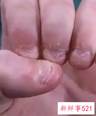 孩子经常咬手指是什么原因