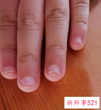 孩子经常咬手指是什么原因