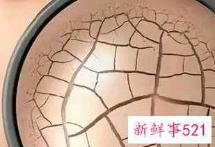 皮肤基底层受损的表现