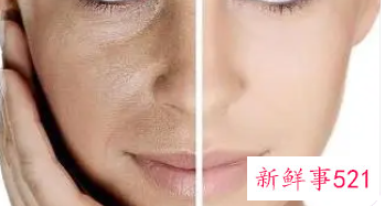 怎么改善暗黄肌肤
