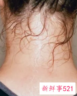 女性稍微一动就满头大汗怎么调理