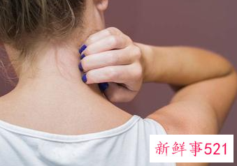 日光性皮炎会全身瘙痒吗