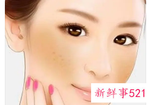 为什么脸色暗沉长斑
