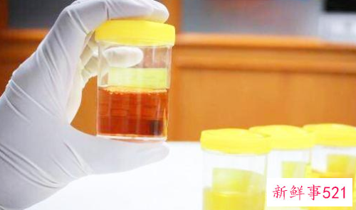 从宝宝的尿液判断是否健康