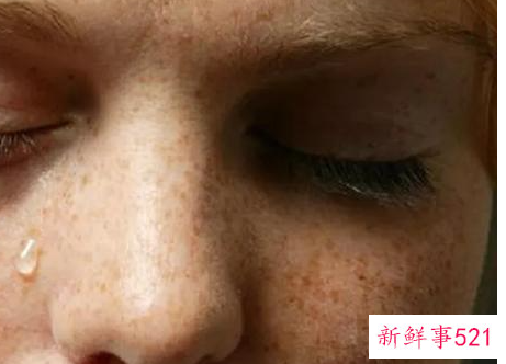 补水的同时用祛斑霜有用么