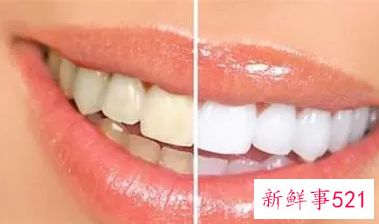 清洁牙齿的方法有哪些