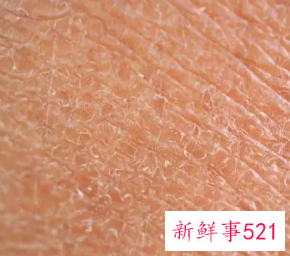 皮肤很粗糙怎么办可以改善吗