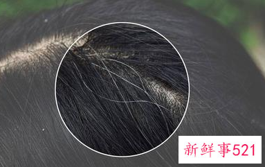 黑芝麻功效和营养价值