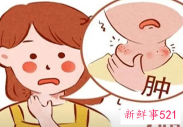 有甲亢的人不能吃什么