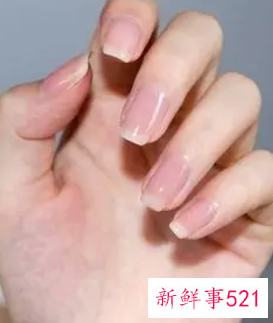 什么油可以保养指甲