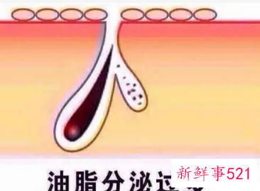 如何抑制油脂分泌