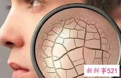 脸反复起皮痒红怎么回事