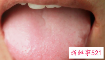 女性稍微一动就满头大汗怎么调理