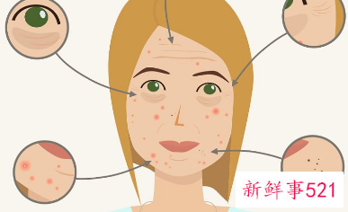 皮肤很粗糙怎么办可以改善吗