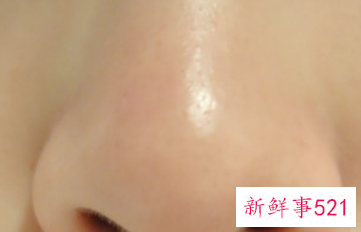 去除黑头好妙招