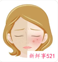 脸上长黄褐斑皮肤暗黄怎么治