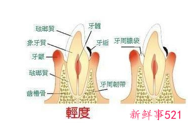 怎样才能使牙齿坚固不易松动