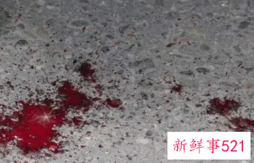 梦见母亲下身流血是什么意思