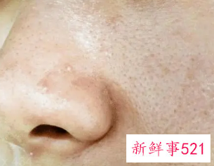 皮肤很粗糙怎么办可以改善吗