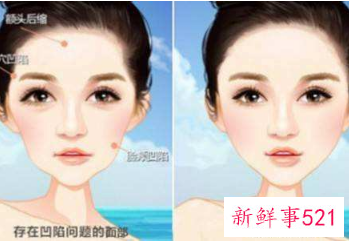 脸部太瘦如何让脸部饱满