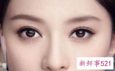 眼袋整形手术一般要多少钱