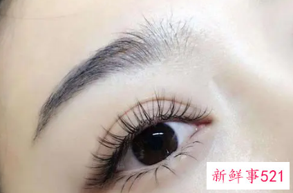 眼睛充血怎么快速消除啊