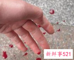 梦见母亲下身流血是什么意思