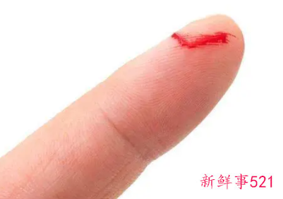 已婚女人梦见自己流鼻血不止