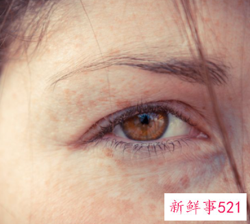 国内最好的除皱方法