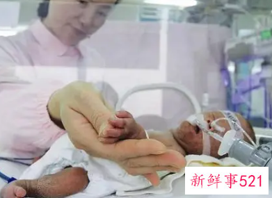 早产儿护理特别注意的是