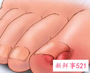 频繁做指甲会怎么样