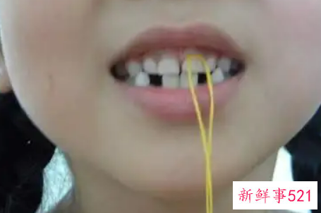 梦见下面的牙齿掉了
