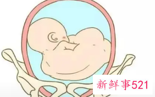 7个月胎位不正怎么办