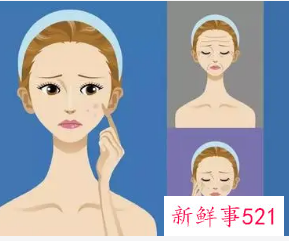 光子 嫩肤能维持多久