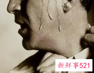 女士汗酸味严重的原因