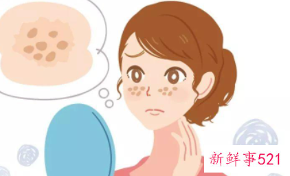 脸上长老年斑怎么去掉