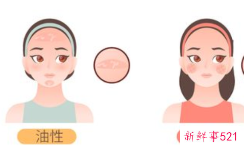 油性皮肤用酸性还是碱性好