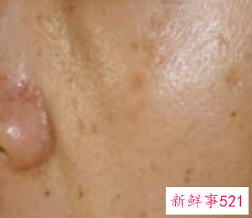 皮肤暗黄没有光泽是什么原因