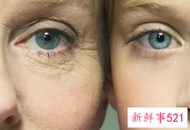 去皱纹针可以维持多久