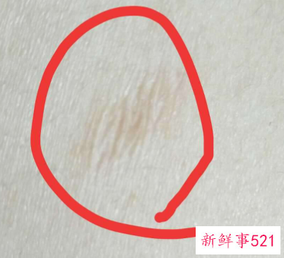 孕妇身上皮肤干燥脱皮起屑擦什么