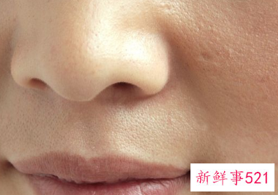 毛孔堵塞怎么清理干净