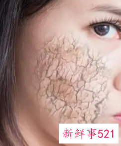 皮肤突然缺水什么原因