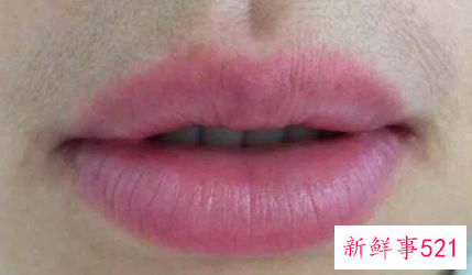 嘴唇上面胡子怎么处理比较好