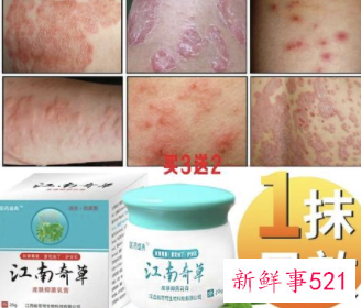 怀孕得了玫瑰糠疹怎么办