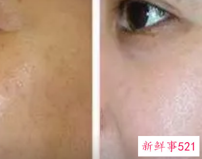 皮肤暗黄没有光泽是什么原因